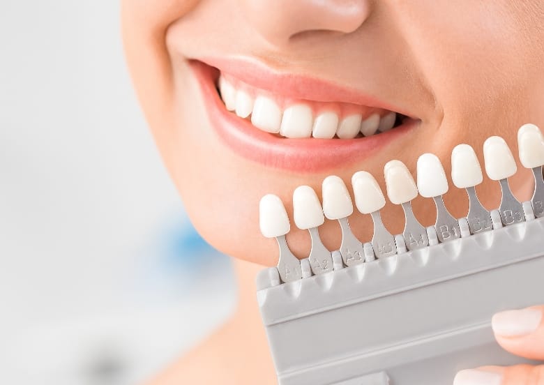 ホワイトニング