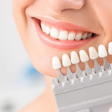 ホワイトニング